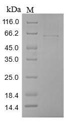 Cartilage intermediate layer protein 1 (CILP), partial, human, recombinant