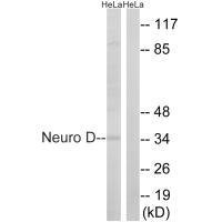 Anti-NEUROD1 (Ab-274)