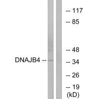 Anti-DNAJB4