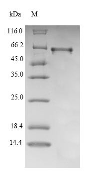25-Hydroxyvitamin D-1 alpha hydroxylase, mitochondrial (Cyp27b1), mouse, recombinant