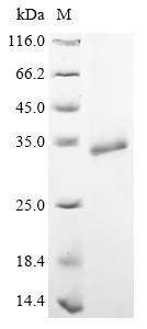 Tetanus toxin, partial, Clostridium tetani, recombinant