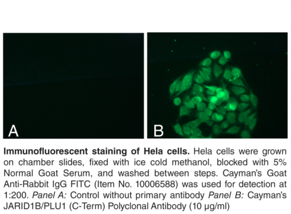 Anti-JARID1B/PLU1 (C-Term)