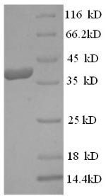 Eukaryotic translation initiation factor 4 gamma 1 (EIF4G1), partial, human, recombinant