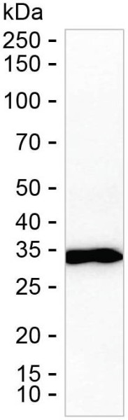 Anti-PRKAB2