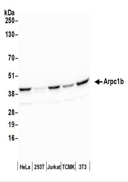 Anti-Arpc1b