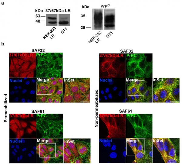 Anti-Prion Protein - SAF 61