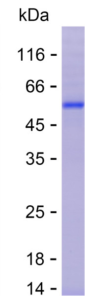 Recombinant Human Vitamin D3 Receptor Protein