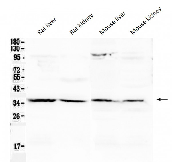 Anti-Annexin A4