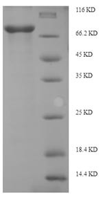 Interferon-induced, double-stranded RNA-activated protein kinase (EIF2AK2), human, recombinant