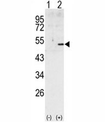 Anti-Cyclin A2 (CCNA2)