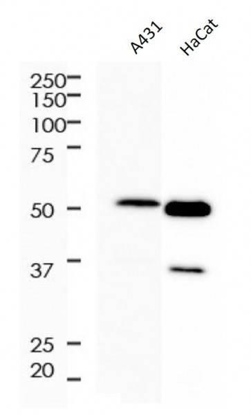 Anti-Cytokeratin 5, clone SQab18106