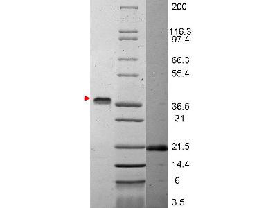 Vascular Endothelial Growth Factor-165, human recombinant (rHuVEGF-165)