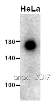 Anti-MSH6, clone SQab1720