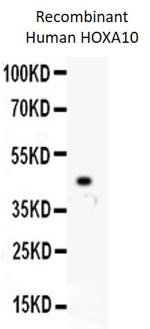 Anti-HOXA10