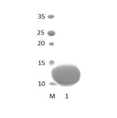 MPDZ_5 PDZ Domain