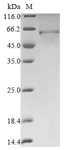Protein DEK (DEK), human, recombinant