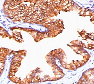 Anti-TMEPAI / PMEPA1, clone PTAI1-1