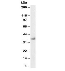 Anti-Delta-Sarcoglycan Biotin Conjugate