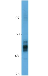 Anti-GLUT2 (human), pAb (IN117)