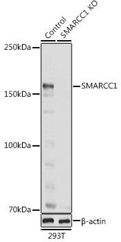 Anti-SMARCC1