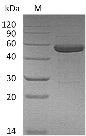 Interleukin-15 &amp; Interleukin-15 receptor subunit alpha (IL15 &amp; IL15RA), partial (Active), human, rec