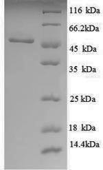 UDP-glucose 6-dehydrogenase (ugd), partial, Escherichia coli, recombinant