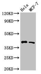 Anti-HLA-B