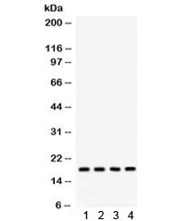 Anti-STMN1 / Stathmin 1