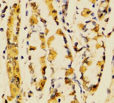 Anti-GNRH1 / Progonadoliberin 1