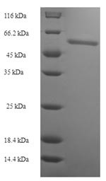 Acidic fibroblast growth factor intracellular-binding protein (FIBP), human, recombinant