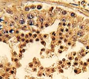 Anti-CDK14 / PFTK1