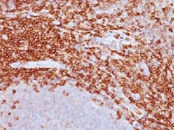 Anti-CD43a