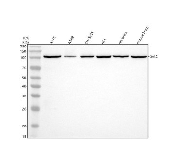 Anti-GALC / Galactocerebrosidase
