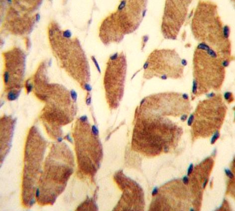 Anti-alpha Actinin 3