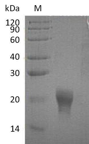 Interleukin-5 (IL5) (Active), human, recombinant