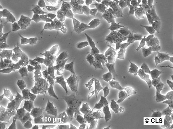 MHH-ES1 Cells