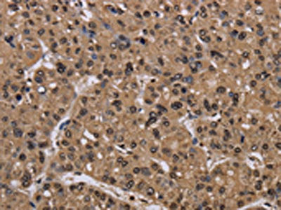 Anti-CSNK2A1