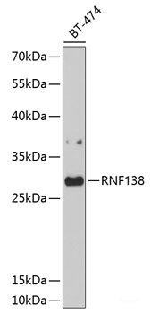 Anti-RNF138