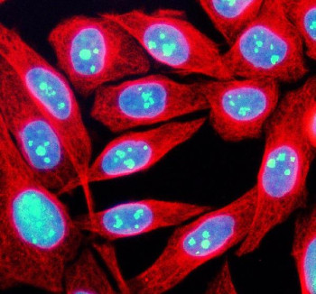Anti-TCOF1 / Treacle protein