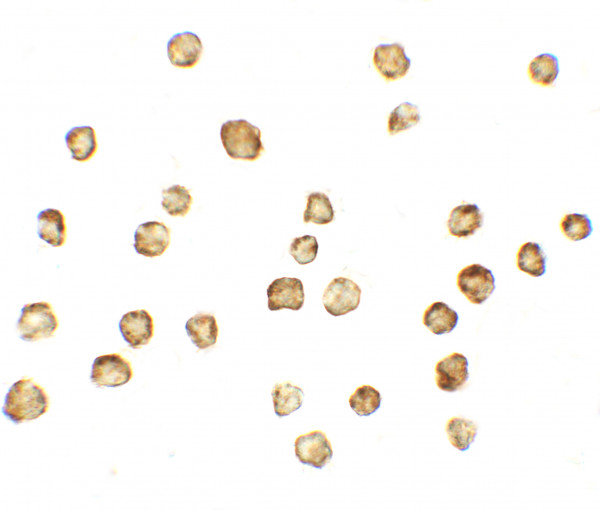 Anti-Mitofusin 1