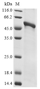 Glycoprotein (G), partial, Rabies virus, recombinant