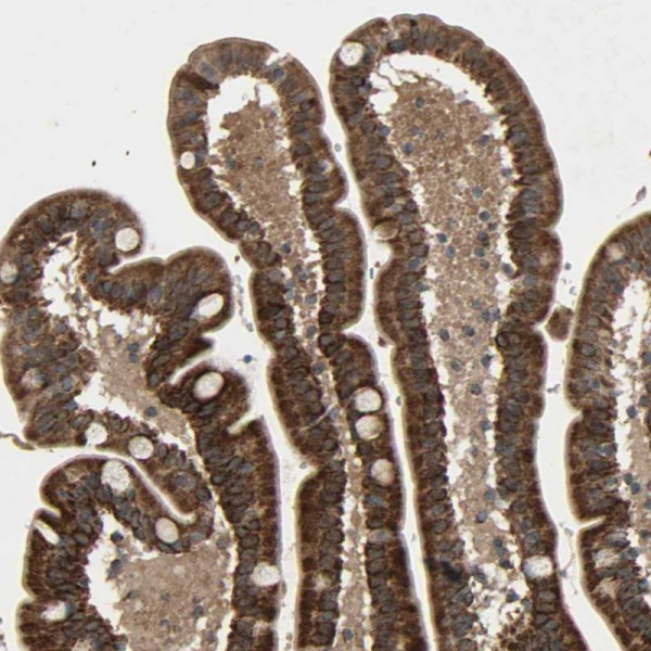 Anti-GLOD5