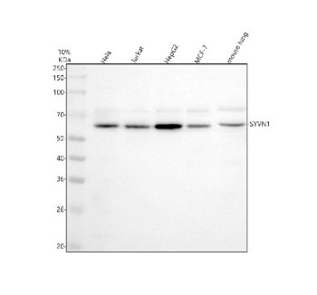 Anti-SYVN1 / Synoviolin / HRD1, clone 32S38