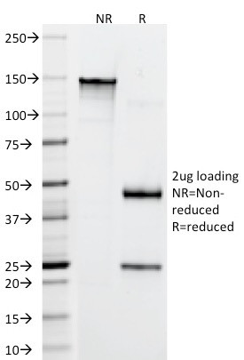 Anti-CD22 / BL-CAM (B-Cell Marker), clone FR10B4