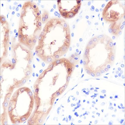 Anti-Recombinant HGD, clone A425