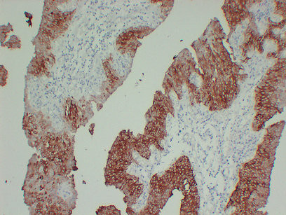 Anti-Cytokeratin 13