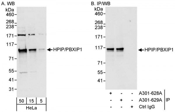 Anti-HPIP