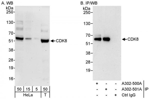 Anti-CDK8