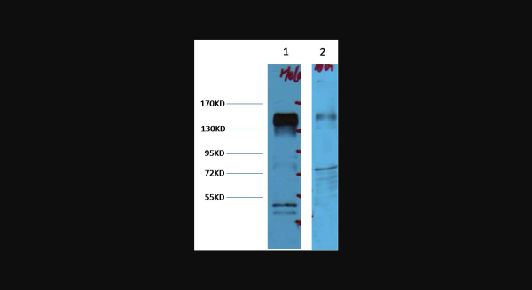 Anti-ErbB-2/HER-2, monoclonal