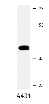 Anti-NMI / n Myc Interactor, clone 1580CT730.43.59